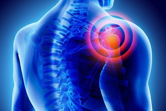 Frozen Shoulder treatment in Delhi