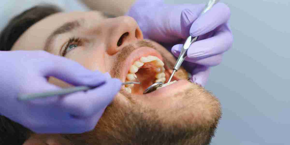 Affordable Dental Implants in Marietta GA - What You Need to Know